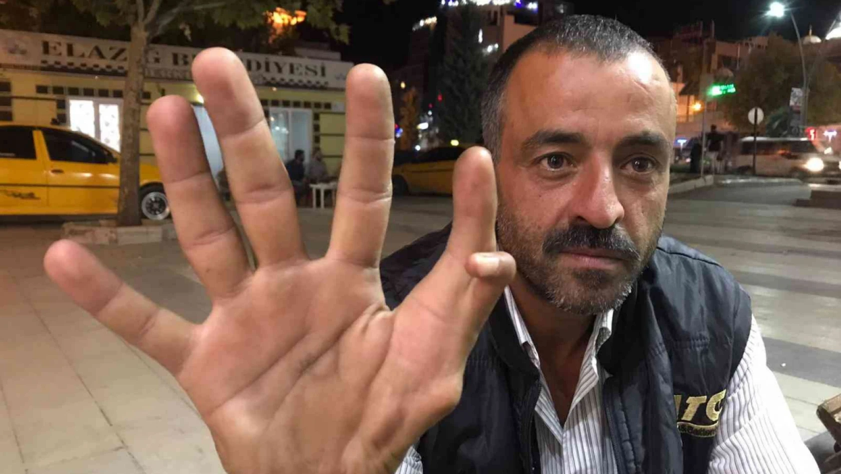 Elazığ'da 11 parmaklı adam görenleri hayrete düşürüyor