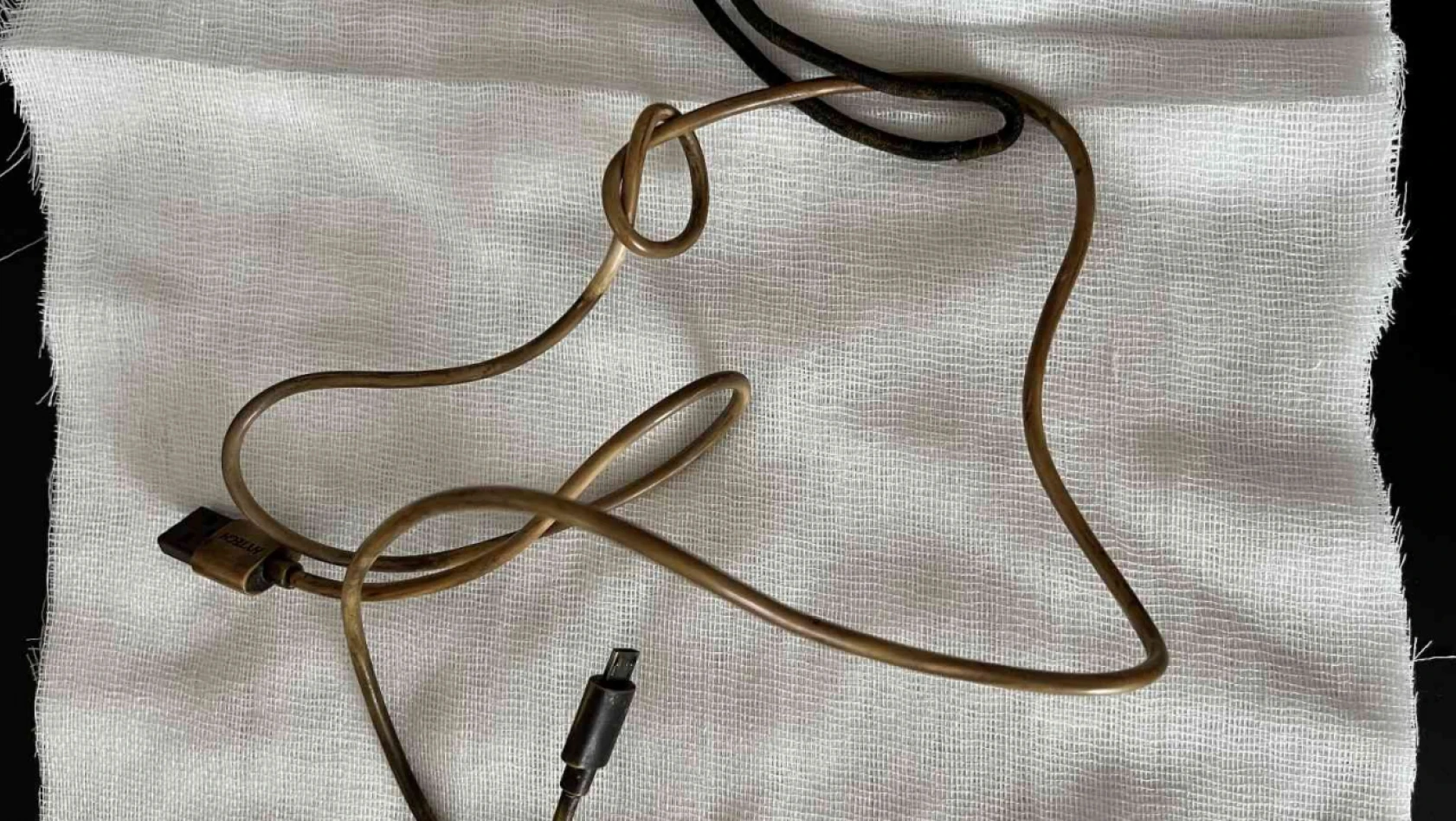 Kusma ve karın ağrısı şikayetiyle doktora giden çocuğun karnından telefon şarj kablosu çıktı