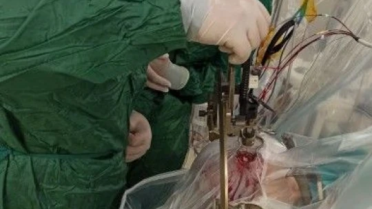 11 yaşındaki çocuğa, uyanıkken beyin pili takıldı