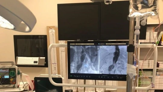 70 yaşındaki hasta akım yönlendirici stent ile sağlığına kavuştu