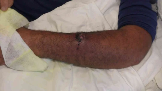 Aldığı etten 'Şarbon' bulaştı, kasap dükkanı mühürlendi