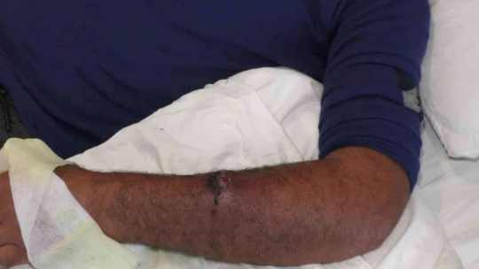 Aldığı etten 'Şarbon' bulaştı, kasap dükkanı mühürlendi