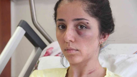 Doktor sevgilisi tarafından 2 saat boyunca öldürülesiye darp edildi