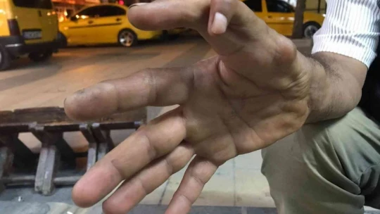 Elazığ'da 11 parmaklı adam görenleri hayrete düşürüyor