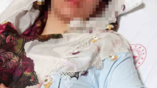 Elazığ'da kayıp kuzenler olayında iddialara yalanlama: 'Beni görünce 2. kattan atladı, yumrukla kendini bu hale getirdi'