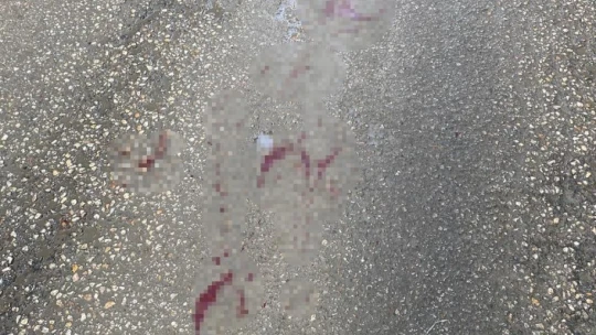 Elazığ'da yan baktın meselesi bıçaklı kavgaya dönüştü: 1 yaralı