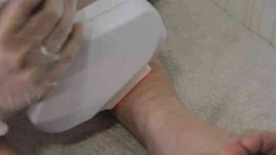 Lazer kadının vücudunu yakmıştı, başka bir güzellik uzmanı tedavisini üstlendi