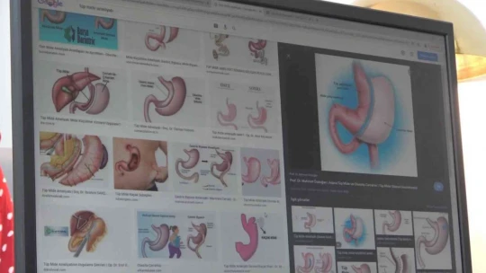 Obeziteye bağlı ölümler sigara nedenli ölümleri geride bıraktı
