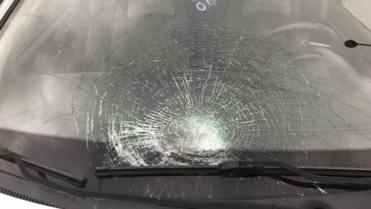 Otomobilin çarptığı kadının bacağı kırıldı