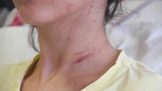 Sevgilisini 2 saat boyunca darp edip 5 yerinden bıçaklayan doktorun 20 yıla kadar hapsi istendi