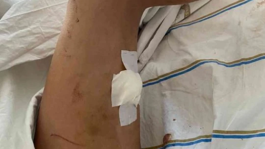 Sevgilisini darp edip 5 yerinden bıçaklamıştı, ilk duruşmada kendini savundu