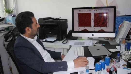 Türk profesörün çalışmaları dünyanın ilgi odağı oldu, birçok ülkeye ihraç edildi
