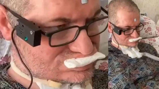 Türkiye'de bir ilk: Geliştirilen bu gözlük, doğal ve yapay göz kırpmayı ayırt edebiliyor