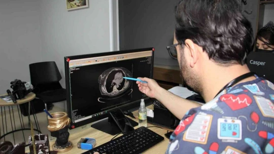 'Kalp hastaları oruç tutmadan önce hekimlerine danışmalı'