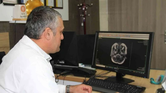MS hastalığı erkeklere oranla kadınlarda 2 kat daha fazla görülür
